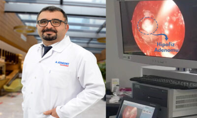 ÖZEL ATAKENT HASTANESİNDEN BİR İLK